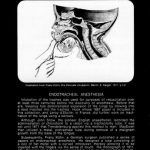 Image of The History of Anesthesiology Reprint Series: Part 10 – Endotracheal Anesthesia. - 1 of 1