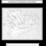 Image of The History of Anesthesiology Reprint Series: Volume 29 – Anesthesia for Operations on the Heart. - 1 of 1