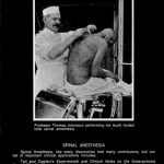 Image of The History of Anesthesiology Reprint Series: Part  3 – Spinal Anesthesia. - 1 of 1