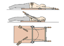 Fries Reviving Apparatus