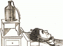 Corning vs Headache